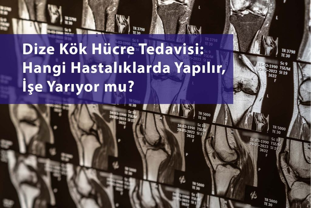 Dizde kök hücre tedavisi yaptıranlar