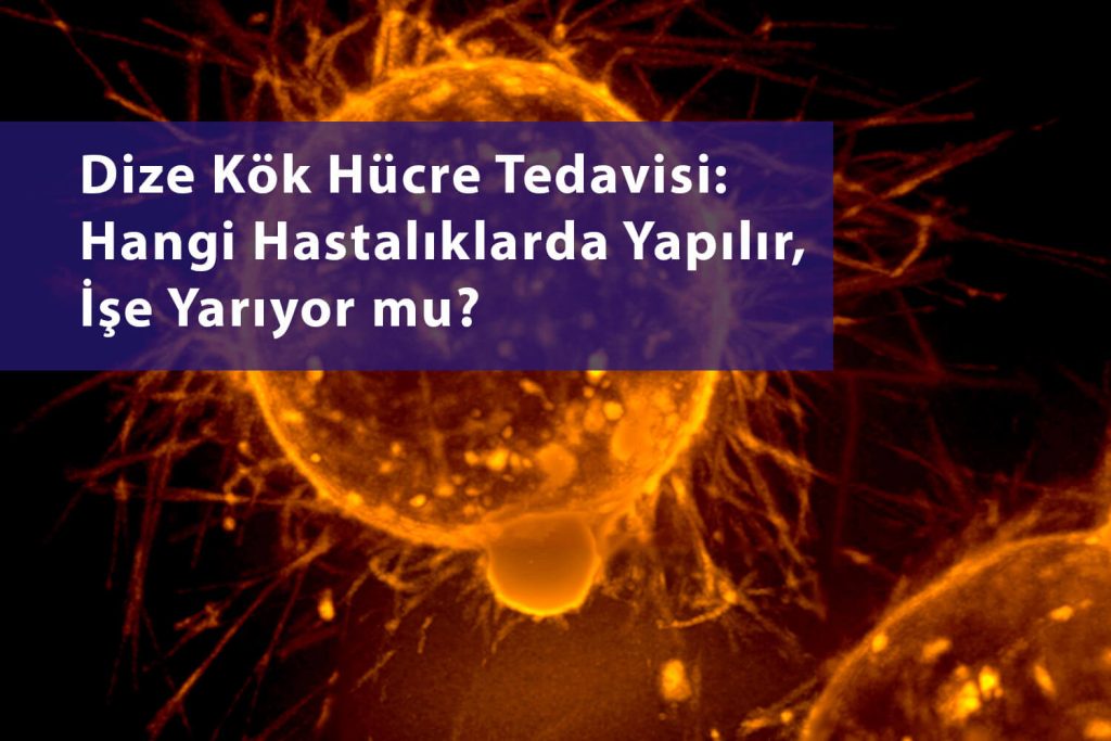 Dize kök hücre tedavisi yapılır mı