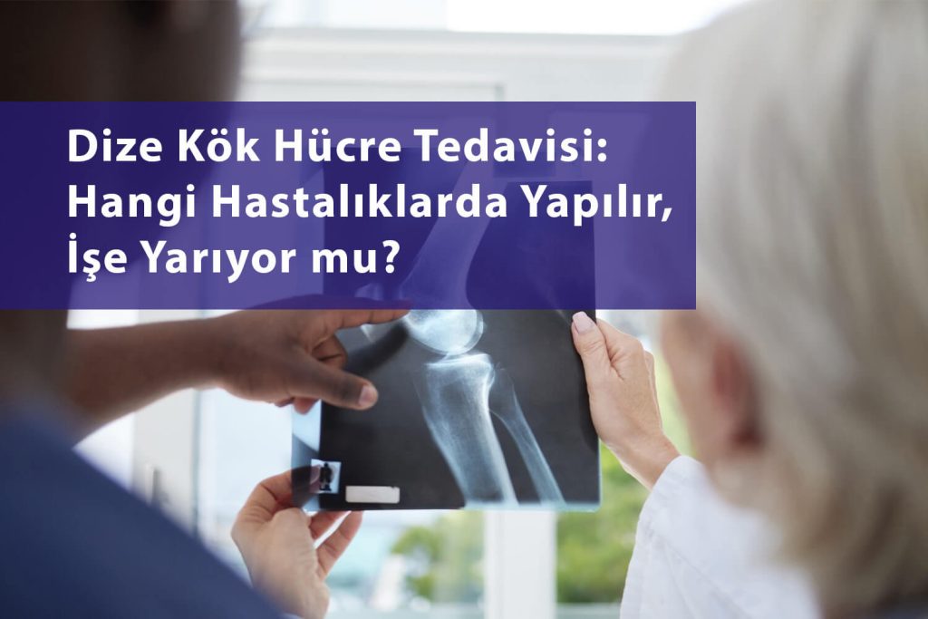 dize kök hücre tedavisi uygulaması kireçlenme